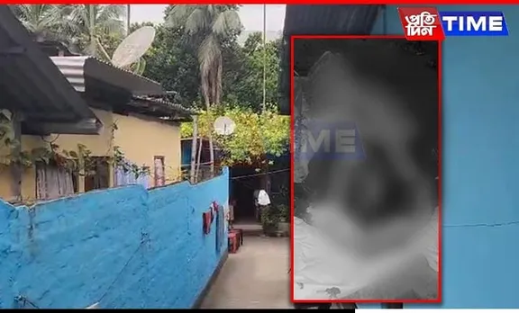Minor Domestic Help Dies From Severe Burns in Guwahati; Cops Alleged of Cover-Up
